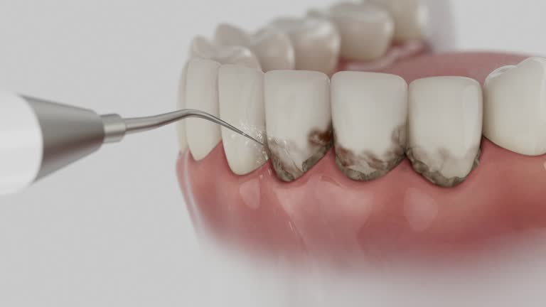 Reliable Dental contractor in Dacono, CO by Smile Center Dentistry